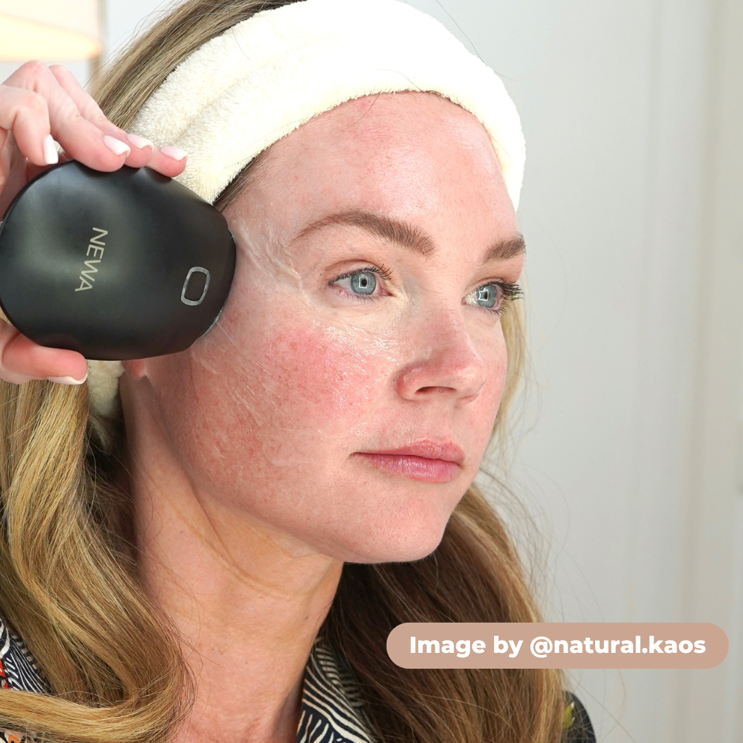 NEWA Classic - RF Wrinkle Reduction Device